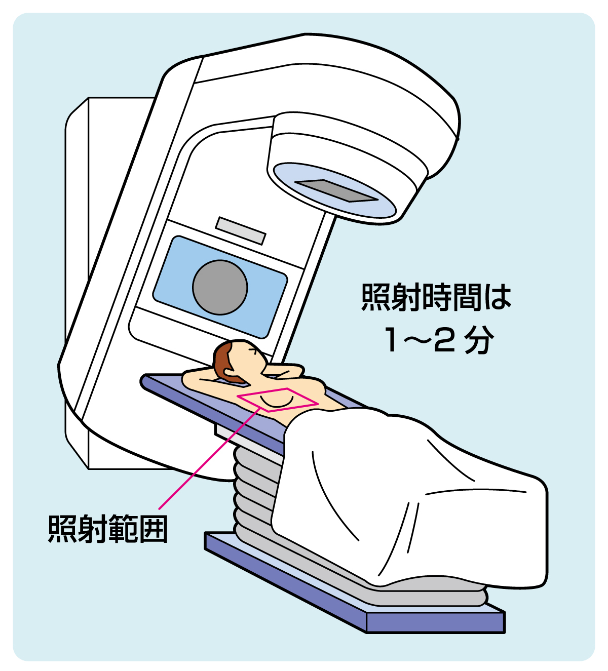 放射線治療